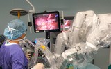 Cận cảnh robot phẫu thuật hiện đại có mặt tại Việt Nam