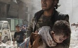 Hình ảnh biết nói về cuộc chiến đẫm máu tại Syria (1)