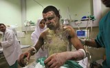[ẢNH] Mỹ lại bị cáo buộc sử dụng vũ khí hủy diệt sau bom nguyên tử tại Syria