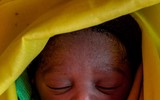 [ẢNH] Trẻ em chết đói trong cuộc khủng hoảng ở Cộng hòa Trung Phi