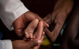 [ẢNH] Trẻ em chết đói trong cuộc khủng hoảng ở Cộng hòa Trung Phi