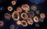 [ẢNH] Chuyên gia Đức đưa ra dự báo gây choáng về thời gian kết thúc đại dịch SARS-CoV-2
