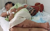 Toàn bộ vụ việc thai phụ 18 tuổi bị tra tấn dã man đến sảy thai ở TP.HCM