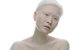 [ẢNH] Ngỡ ngàng trước vẻ đẹp khác biệt của những người mẫu bạch tạng nổi tiếng thế giới