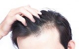 [ẢNH] Những thói quen gây rụng tóc dễ mắc phải
