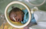 [ẢNH] Rơi nước mắt với những em bé chưa kịp sống đã chết chỉ vì máy thở... không có điện