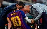 [ẢNH] Chấn thương nặng, Messi vẫn tươi rói xuống phố với cái tay bó bột