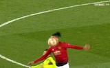 [ẢNH] Sốc với hình ảnh Messi mặt mũi bầm dập sau khi lĩnh đòn của Smalling
