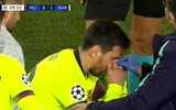 [ẢNH] Sốc với hình ảnh Messi mặt mũi bầm dập sau khi lĩnh đòn của Smalling