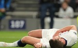 [ẢNH] Rợn người hình ảnh sao Tottenham nằm sân với khuôn mặt đầm đìa máu