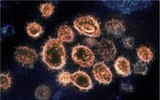 [ẢNH] Triệu chứng mới ở người nhiễm biến chủng của dịch Covid-19