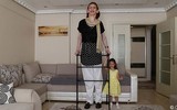 Người phụ nữ cao nhất thế giới do mắc bệnh hiếm
