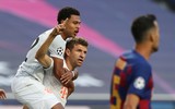 [ẢNH] Messi ôm mặt đau khổ trong đêm kinh hoàng của Barca