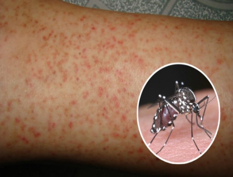 10 loại dịch bệnh xảy ra vào mùa hè và cách phòng chống
