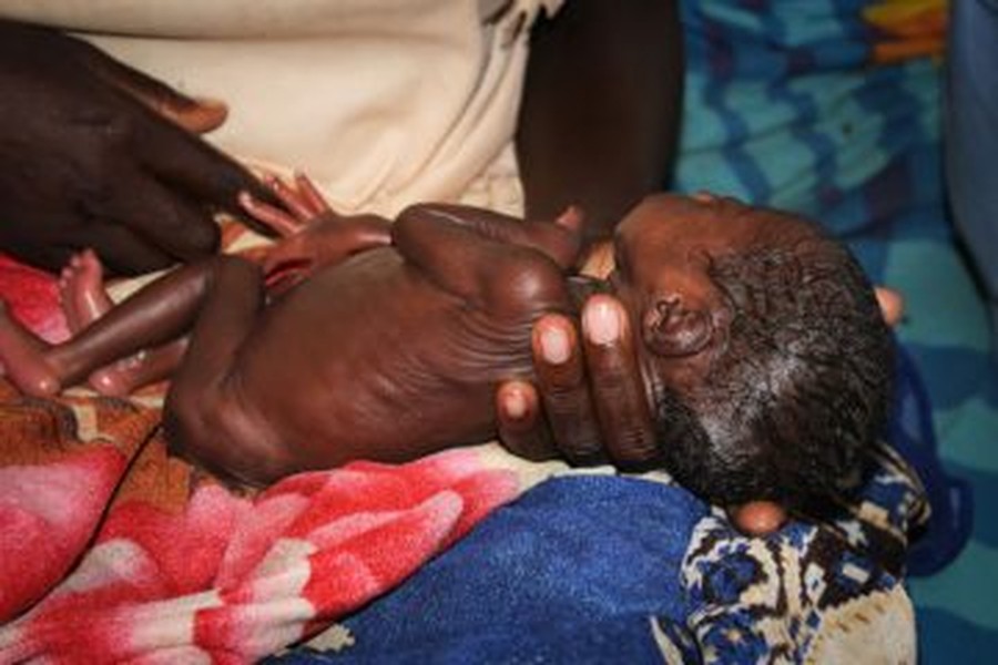 [ẢNH] Rơi nước mắt với những em bé chưa kịp sống đã chết chỉ vì máy thở... không có điện