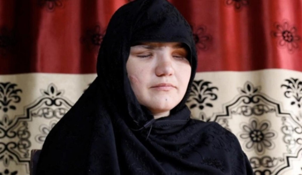[ẢNH] Thủ lĩnh chột mắt khét tiếng Taliban khôi phục luật hành hình chặt tay chân