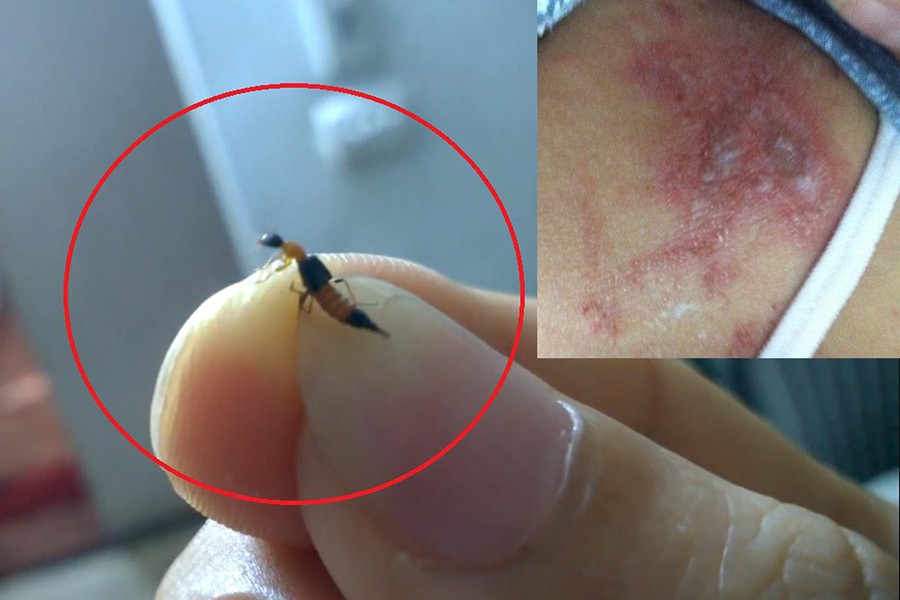 [Ảnh] Nhận diện những dấu hiệu tổn thương do kiến ba khoang và cách xử lý 