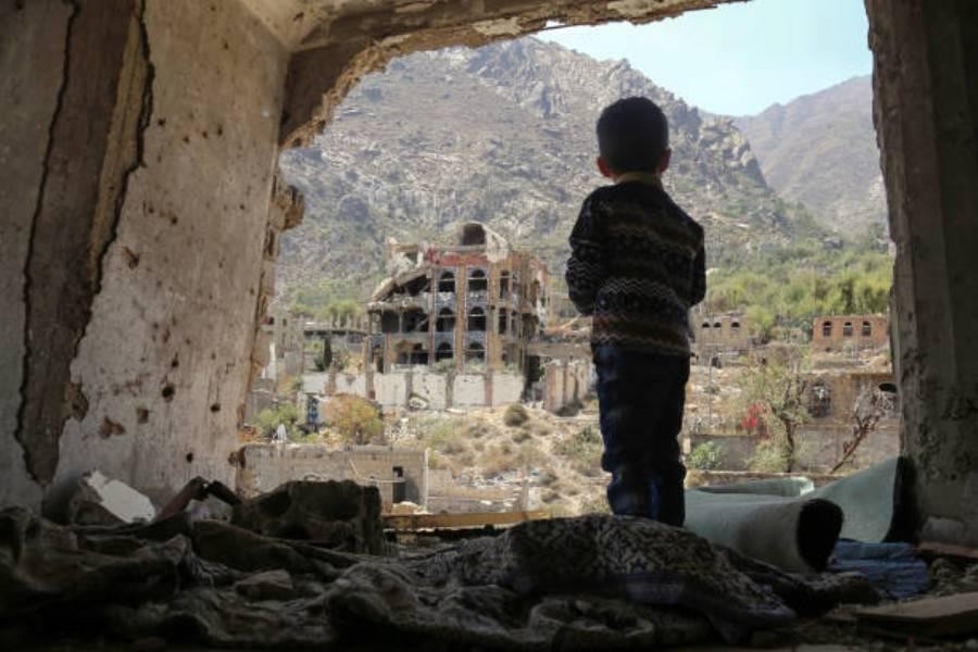 [ẢNH] Xót xa cậu bé Yemen 7 tuổi chỉ nặng có 7kg vì nạn đói