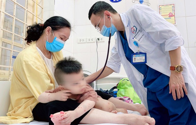 Số mắc tay chân miệng ở Hà Nội tăng trở lại trong 2 tuần vừa qua ảnh 1