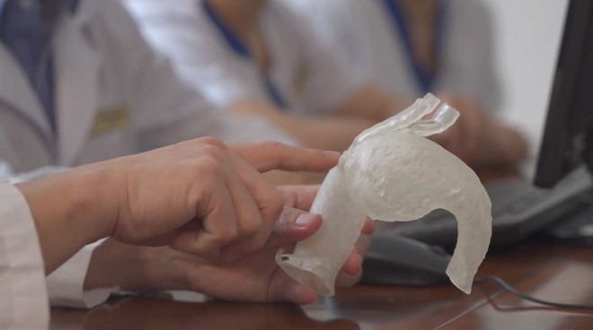 Vinmec áp dụng công nghệ 3D hỗ trợ can thiệp tim mạch lần đầu tiên ở Đông Nam Á ảnh 1